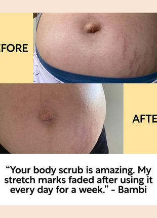 Natural Bodycare Bundle - Skincare Set with Scrub & Moisturizer