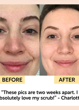 Travel-Size Natural Skincare Bundle (Clean & Plant-Based)